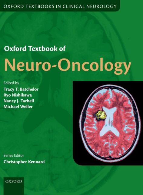 Oxford Textbook of Neuro-Oncology, Hardback Book
