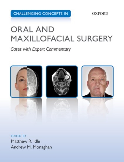 Challenging Concepts in Oral and Maxillofacial Surgery : Cases with Expert Commentary, Paperback / softback Book