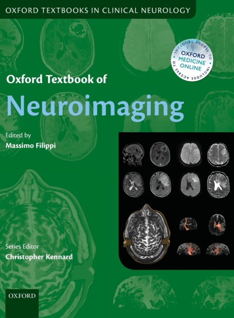 Oxford Textbook of Neuroimaging, Hardback Book