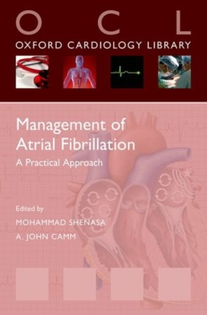 Management of Atrial Fibrillation : A Practical Approach, Paperback / softback Book