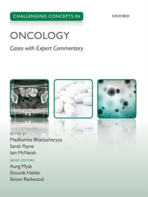 Challenging Concepts in Oncology, Paperback / softback Book