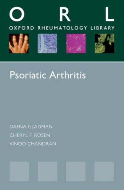 Psoriatic Arthritis, Paperback / softback Book