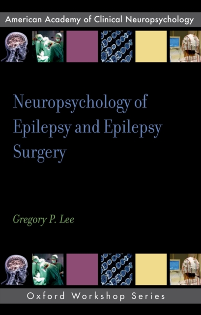 Neuropsychology of Epilepsy and Epilepsy Surgery, PDF eBook