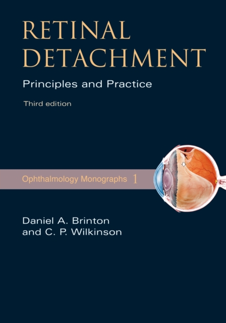 Retinal Detachment : Priniciples and Practice, PDF eBook