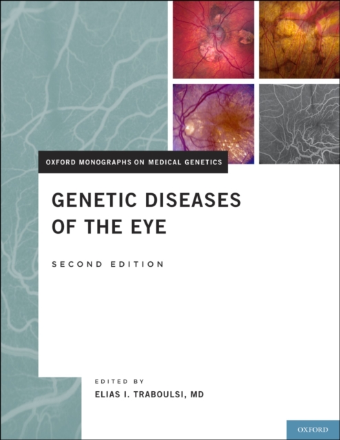 Genetic Diseases of the Eye, PDF eBook