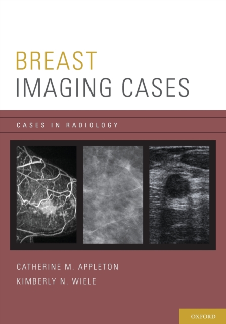 Breast Imaging Cases, Paperback / softback Book