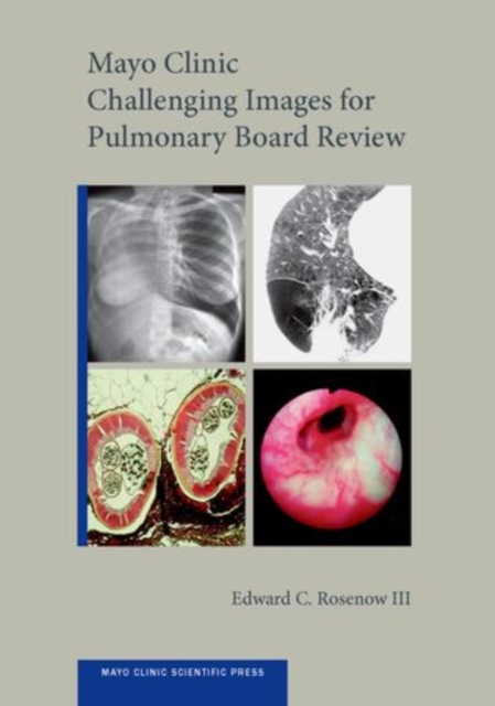 Mayo Clinic Challenging Images for Pulmonary Board Review, CD-ROM Book