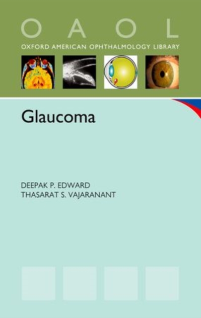 Glaucoma, Paperback / softback Book