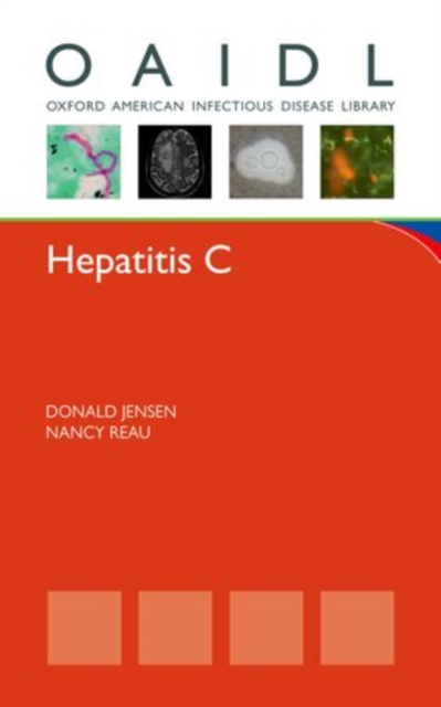 Hepatitis C, Paperback / softback Book