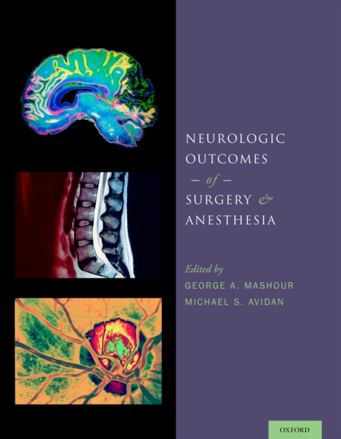 Neurologic Outcomes of Surgery and Anesthesia, PDF eBook