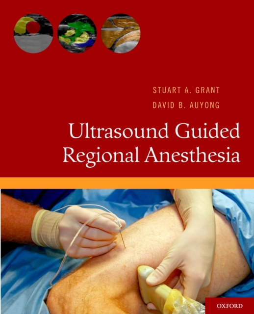 Ultrasound Guided Regional Anesthesia, PDF eBook