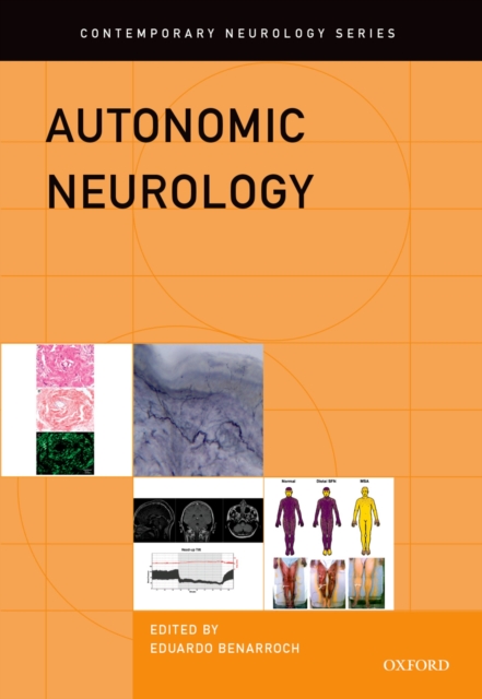 Autonomic Neurology, PDF eBook