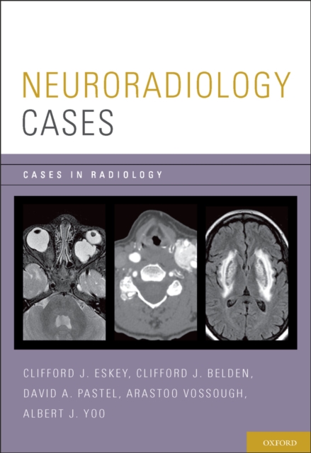 Neuroradiology Cases, PDF eBook