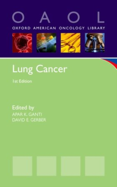 Lung Cancer, Paperback / softback Book