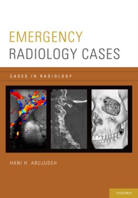 Emergency Radiology Cases, Paperback / softback Book