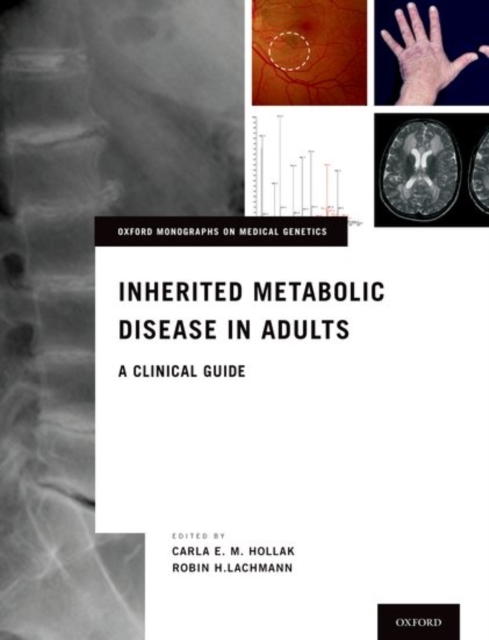 Inherited Metabolic Disease in Adults : A Clinical Guide, Hardback Book