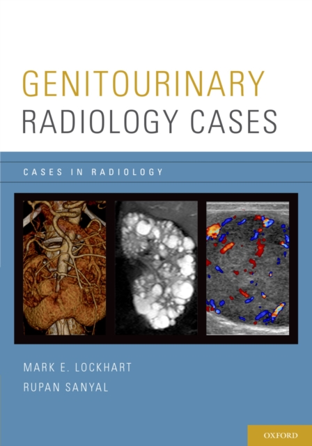Genitourinary Radiology Cases, EPUB eBook