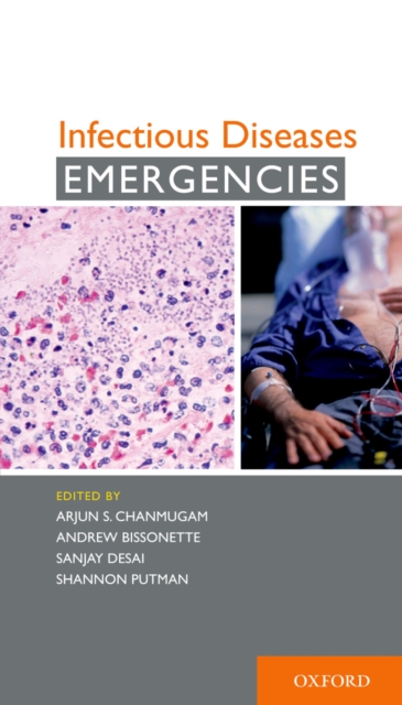 Infectious Diseases Emergencies, EPUB eBook