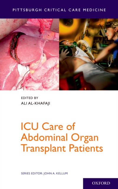 ICU Care of Abdominal Organ Transplant Patients, PDF eBook