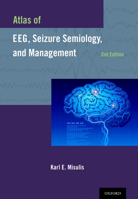 Atlas of EEG, Seizure Semiology, and Management, PDF eBook