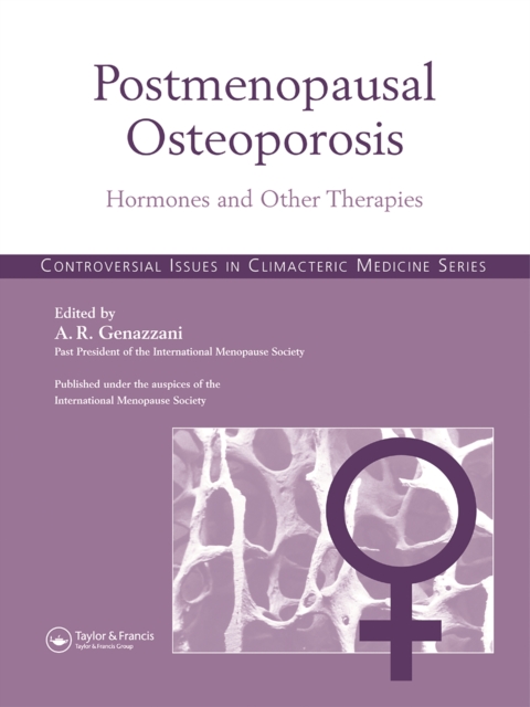 Postmenopausal Osteoporosis : Hormones & Other Therapies, PDF eBook