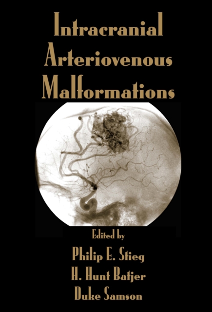 Intracranial Arteriovenous Malformations, PDF eBook