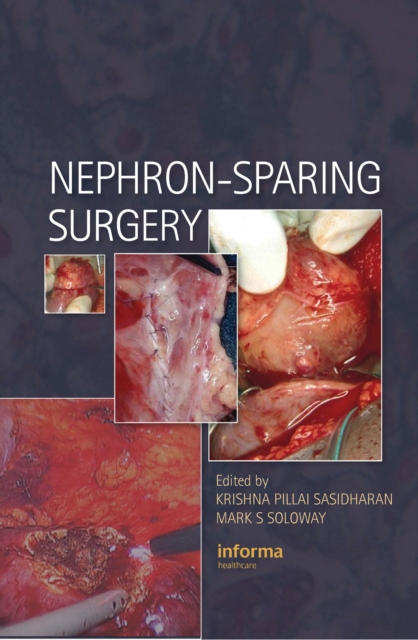 Nephron-Sparing Surgery, PDF eBook