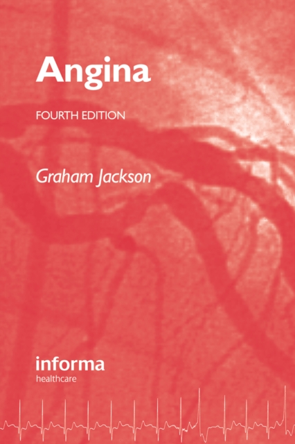 Angina, PDF eBook