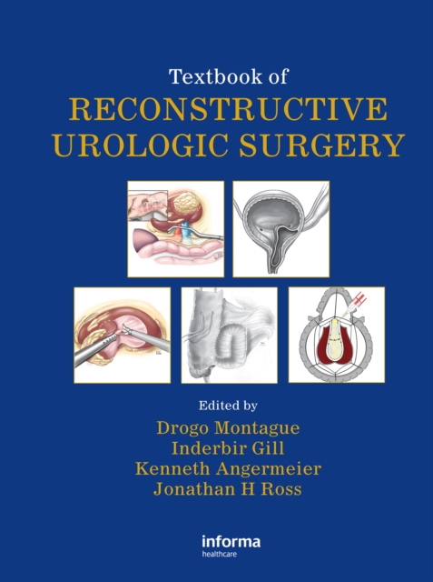 Textbook of Reconstructive Urologic Surgery, PDF eBook