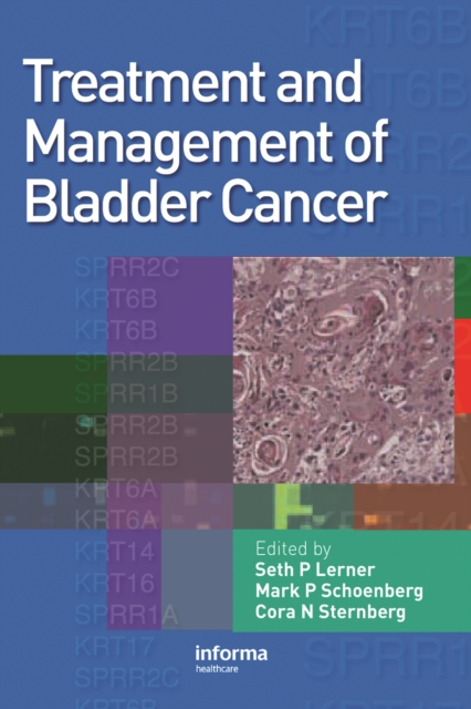 Treatment and Management of Bladder Cancer, PDF eBook