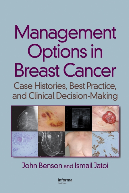 Management Options in Breast Cancer : Case Histories, Best Practice, and Clinical Decision-Making, PDF eBook