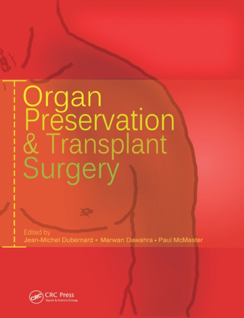 Organ Preservation and Transplant Surgery, PDF eBook
