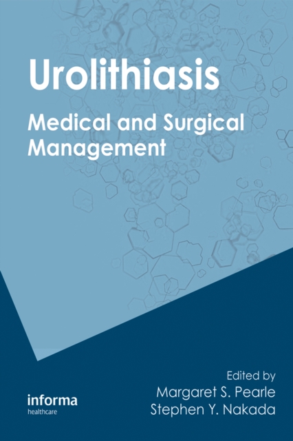 Urolithiasis : Medical and Surgical Management of Stone Disease, PDF eBook