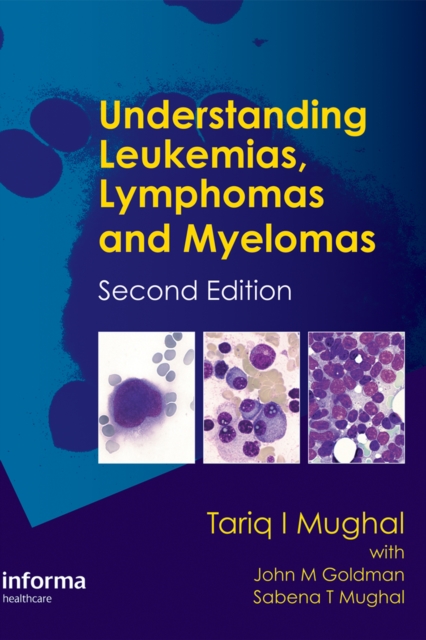 Understanding Leukemias, Lymphomas and Myelomas, PDF eBook
