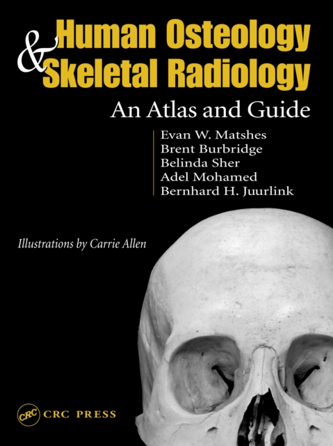 Human Osteology and Skeletal Radiology : An Atlas and Guide, PDF eBook