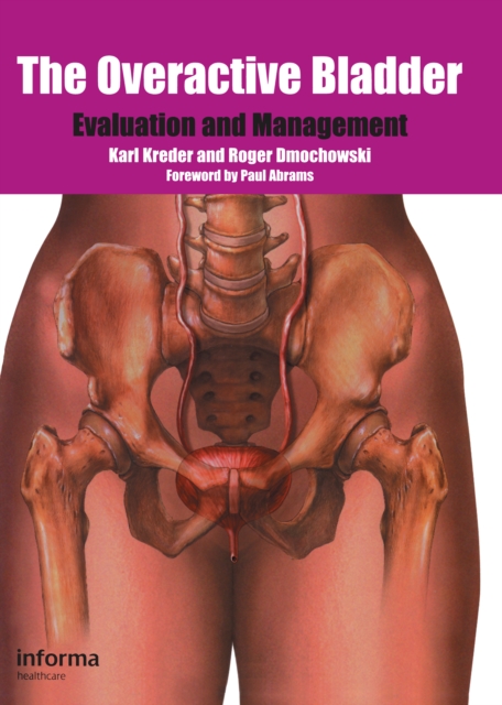 The Overactive Bladder : Evaluation and Management, PDF eBook