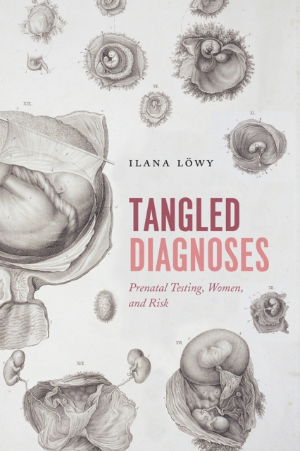 Tangled Diagnoses : Prenatal Testing, Women, and Risk, Hardback Book