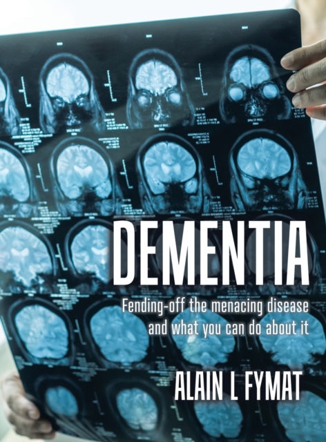 Dementia : Fending-off the Menacing Disease and What You Can Do About It, Hardback Book