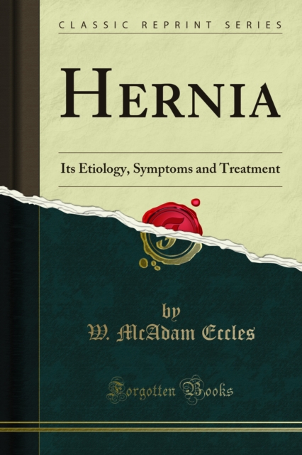 Hernia : Its Etiology, Symptoms and Treatment, PDF eBook