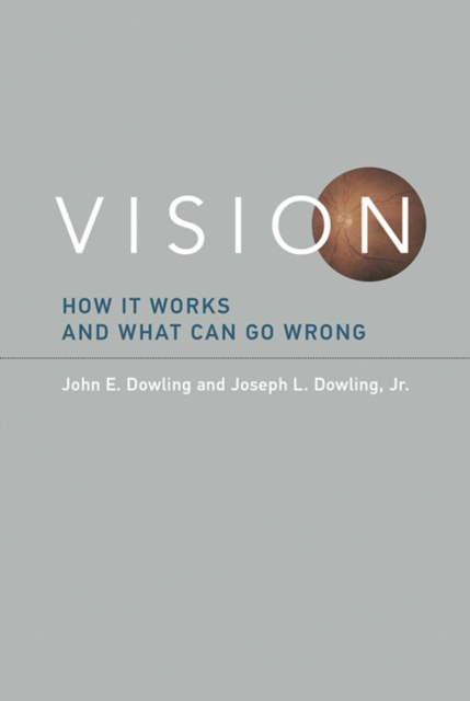 Vision : How It Works and What Can Go Wrong, Hardback Book