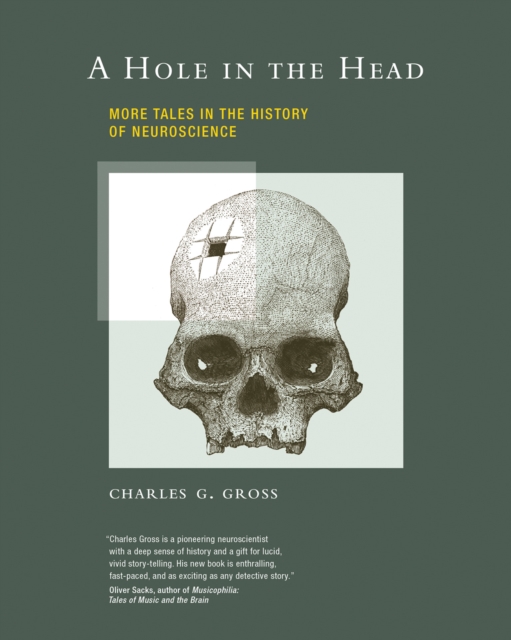 Hole in the Head, EPUB eBook