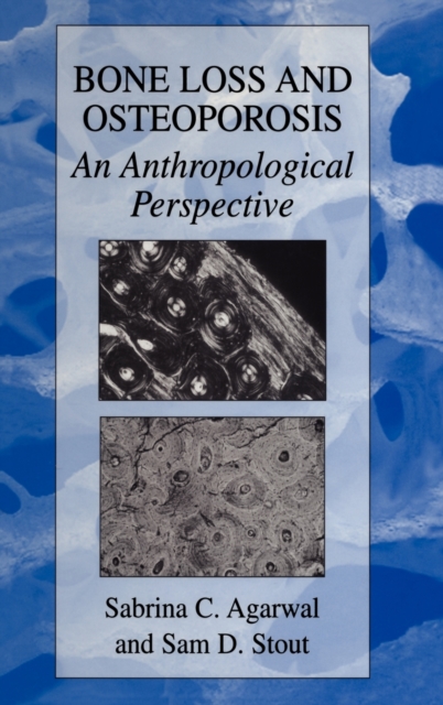 Bone Loss and Osteoporosis : An Anthropological Perspective, Hardback Book