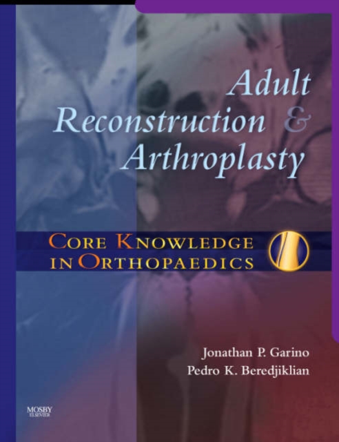 Core Knowledge in Orthopaedics: Adult Reconstruction and Arthroplasty, Hardback Book