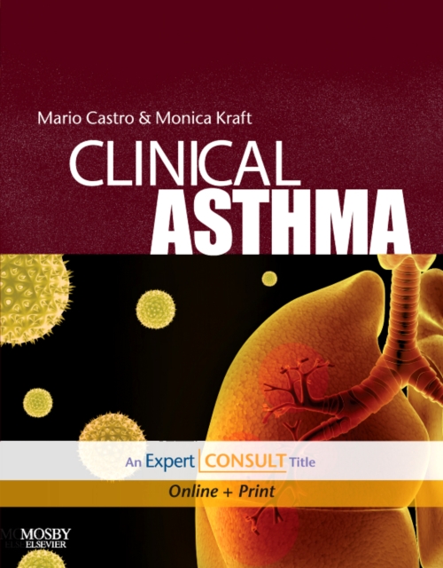 Clinical Asthma, Hardback Book
