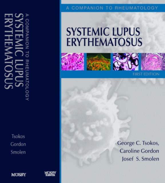 Systemic Lupus Erythematosus : Companion to "Rheumatology" 3r.e., Hardback Book