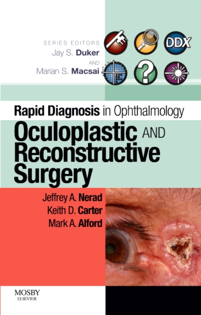 Rapid Diagnosis in Ophthalmology Series: Oculoplastic and Reconstructive Surgery, Paperback / softback Book