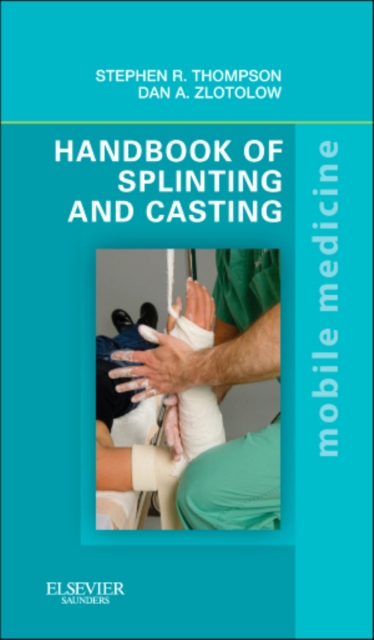Handbook of Splinting and Casting : Mobile Medicine Series, Paperback / softback Book