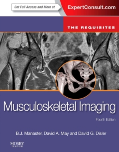 Musculoskeletal Imaging: The Requisites, Hardback Book