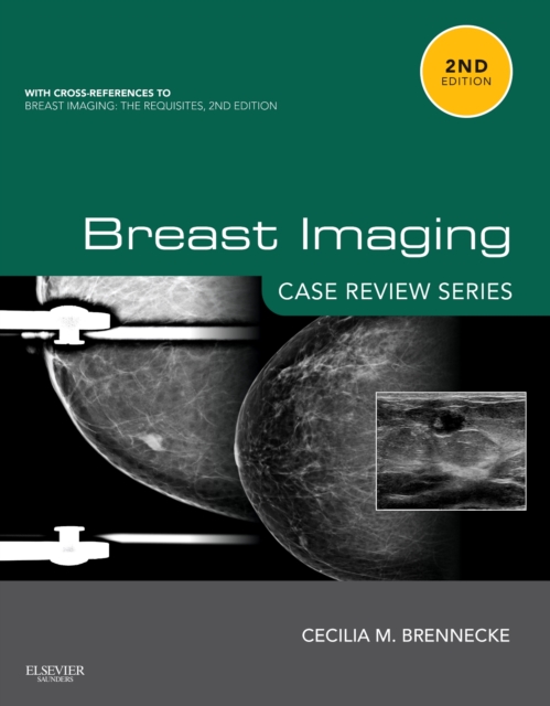 Breast Imaging: Case Review Series, Paperback / softback Book