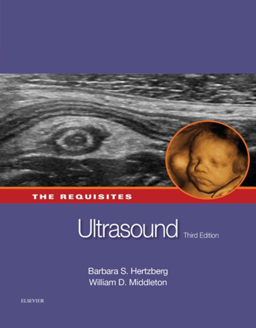 Ultrasound: The Requisites, EPUB eBook